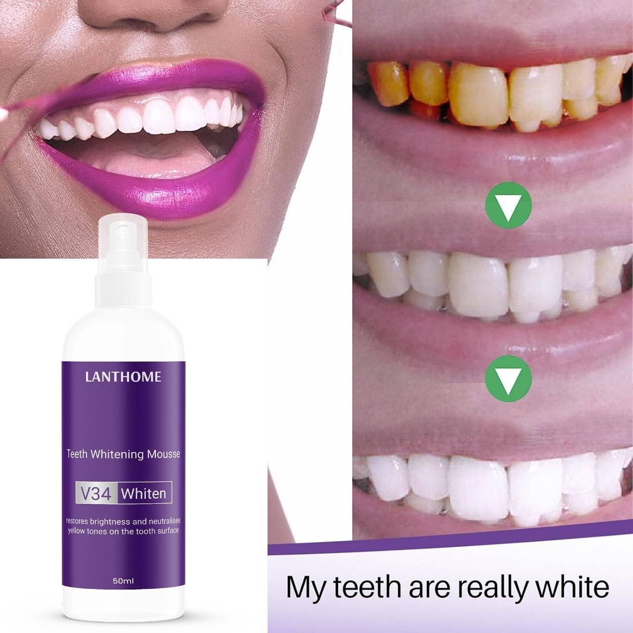 Lanthome Teeth Whitening Spray Mousse V34 Whiten 50ml (Pack Of 2)