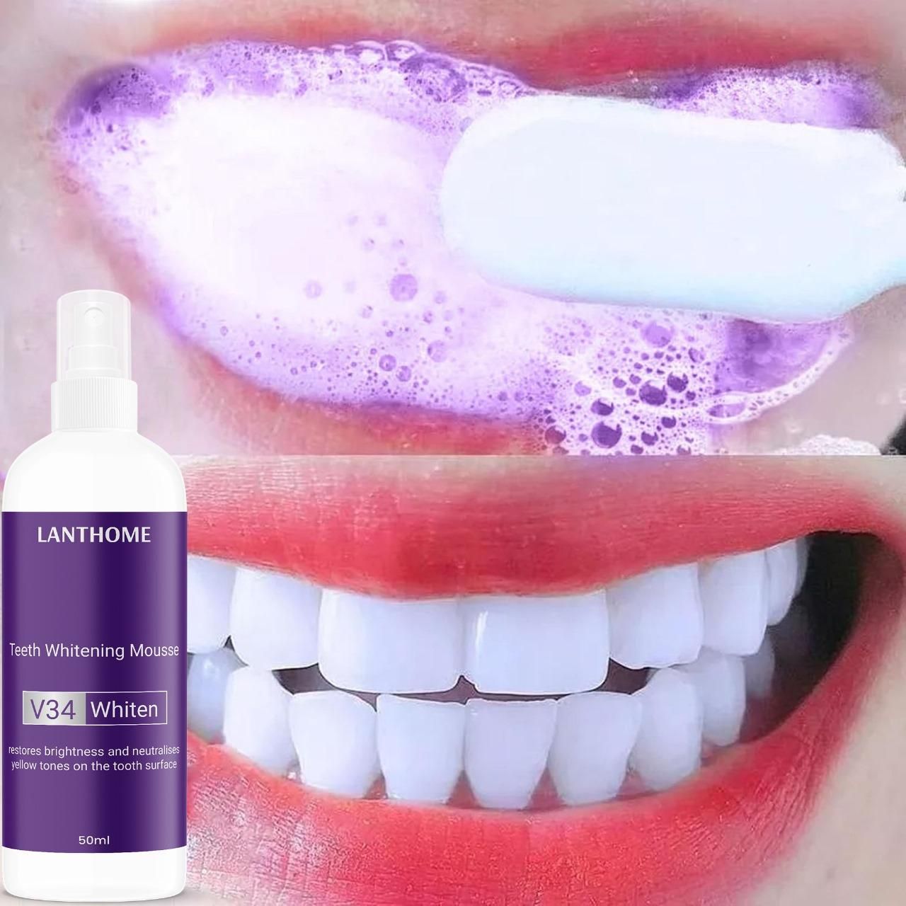 Lanthome Teeth Whitening Spray Mousse V34 Whiten 50ml (Pack Of 2)