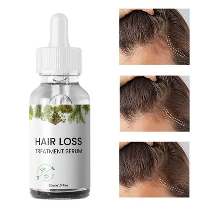 Hair Loss Treatment Serum 30Ml (Pack Of 2)